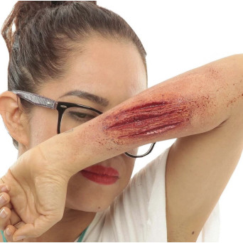 Herida de Cuchillo