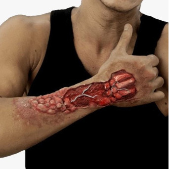 Herida de Brazo Comido de Látex